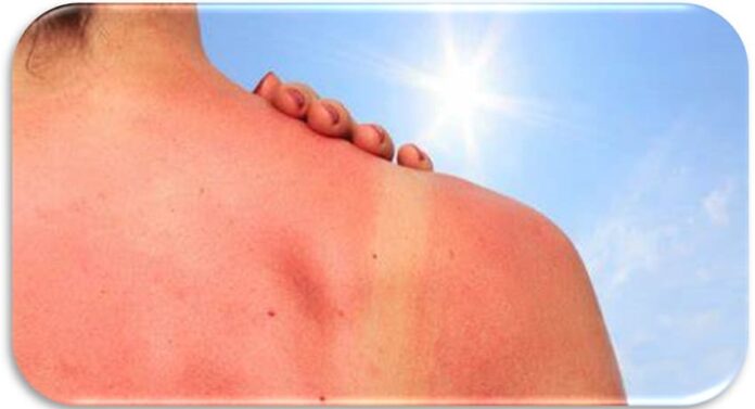 sol (1)